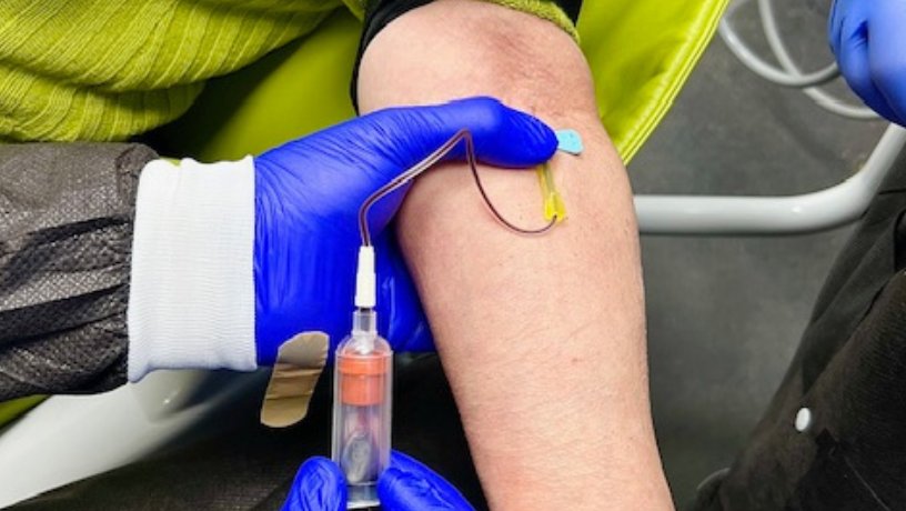 iv-sedation